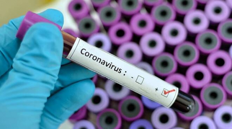 Coronavirus, nessuna persona in reparto nel Vibonese. Il bollettino