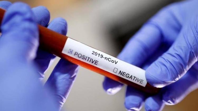Coronavirus, 31 nuovi casi in Calabria. Il bollettino