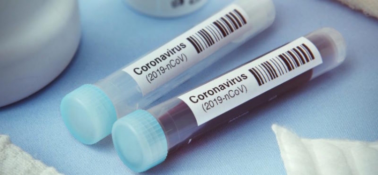Coronavirus, 335 positivi nelle ultime 24 ore in Calabria. Il bollettino