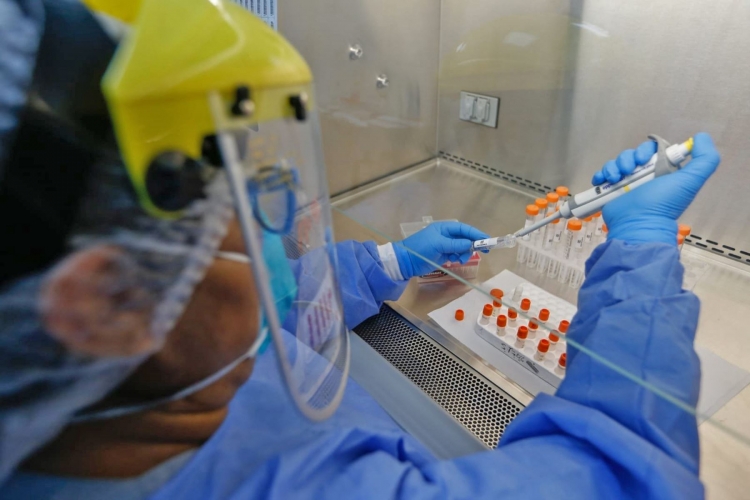 Coronavirus, 67 nuovi positivi su circa 3mila tamponi effettuati in Calabria. Il bollettino