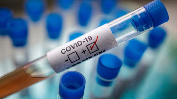 Coronavirus, nuovo caso positivo a Serra San Bruno
