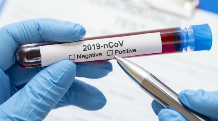 Coronavirus, 19 positivi nelle ultime 24 ore in Calabria. Il bollettino