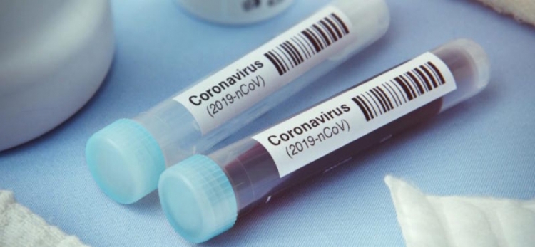 Coronavirus, 130 nuovi positivi in Calabria su 2389 tamponi effettuati. Il bollettino