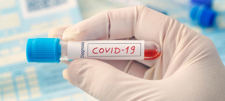 Coronavirus, 2 nuovi casi di positività in Calabria. Il bollettino