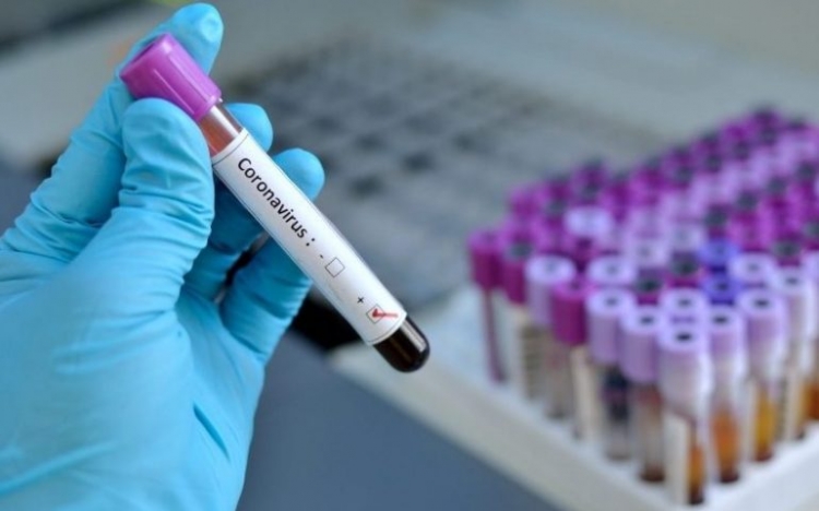 Coronavirus, 4 nuovi casi positivi nelle ultime 24 ore in Calabria. Il bollettino