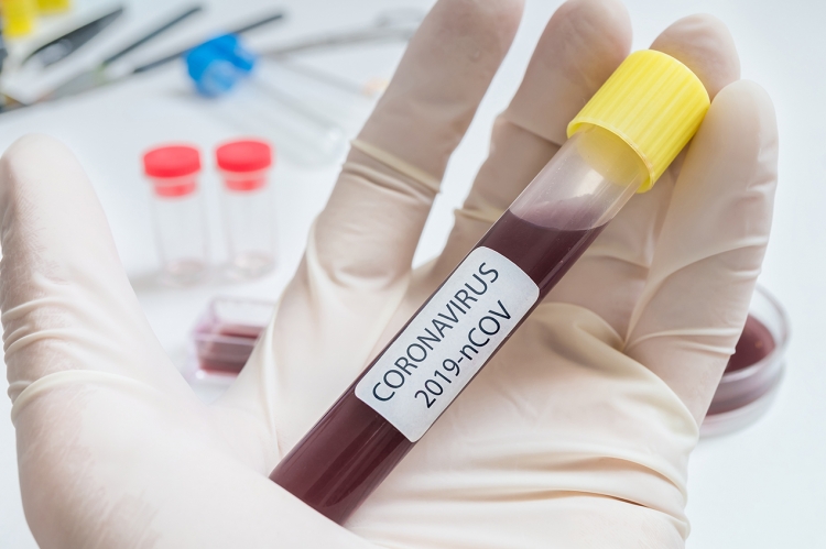 Coronavirus, 3 nuovi contagi nel Vibonese. Il bollettino della Regione
