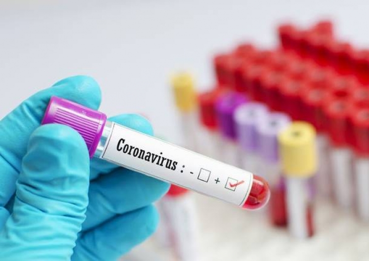 Coronavirus, 118 nuovi positivi in Calabria su 1042 tamponi effettuati. Il bollettino