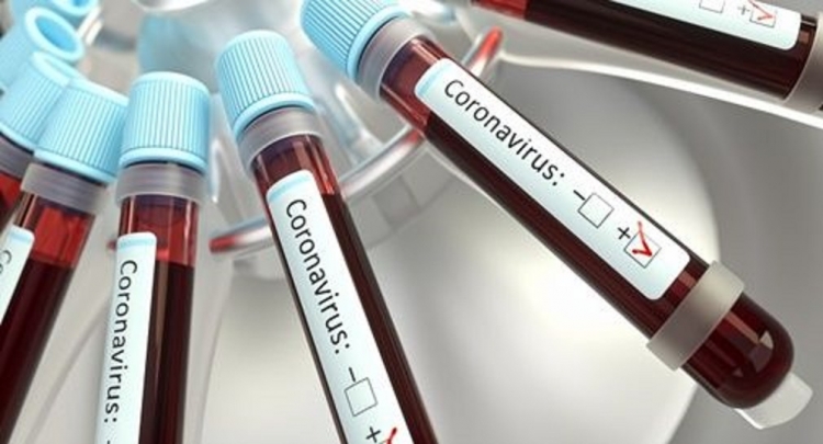 Coronavirus, 19 nuovi casi in Calabria. Sono quasi tutti del Reggino. Il bollettino