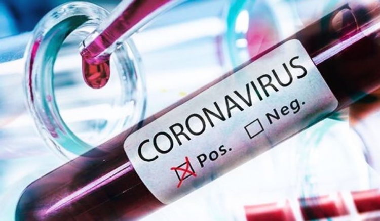 Coronavirus, 409 positivi in Calabria di cui 73 in provincia di Vibo. Il bollettino