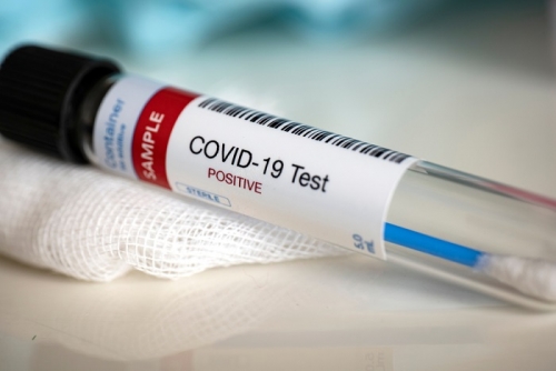 Coronavirus, 318 nuovi positivi e 7 decessi nelle ultime 24 ore in Calabria. Il bollettino