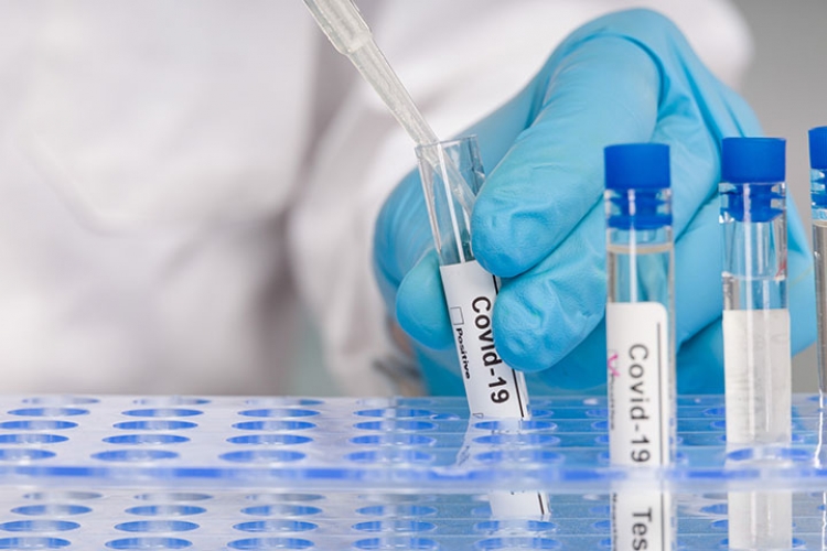 Coronavirus, quasi 400 nuovi casi in Calabria. Il bollettino della Regione