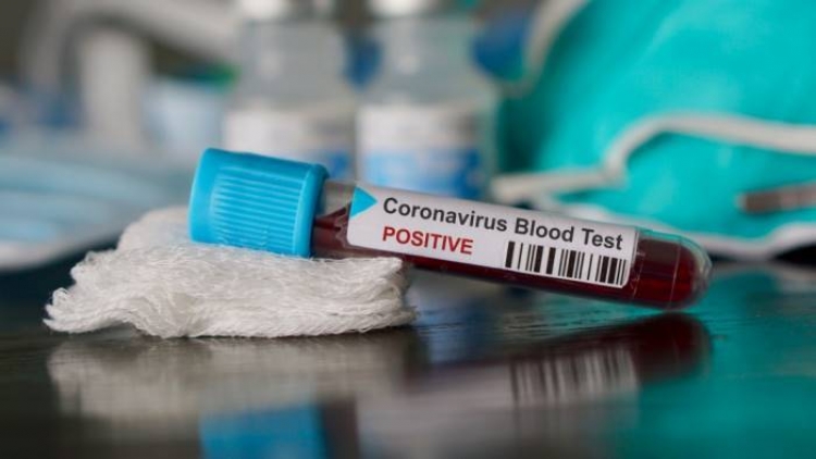 Coronavirus, 3 nuovi positivi in Calabria su 674 tamponi effettuati. Il bollettino