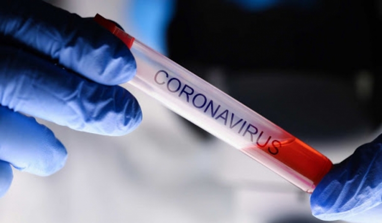 Coronavirus, 114 nuovi positivi in Calabria su oltre 2500 tamponi effettuati. Il bollettino della Regione